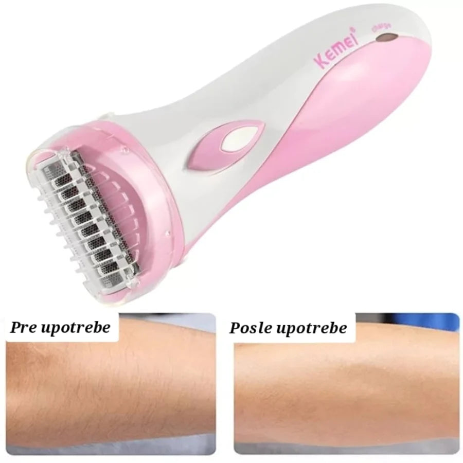 Epilator za telo